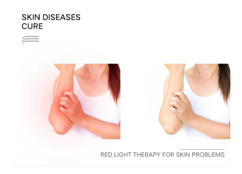 red light therapy light7.jpg