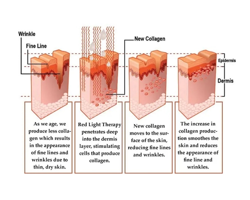 What are the effects of red light therapy?